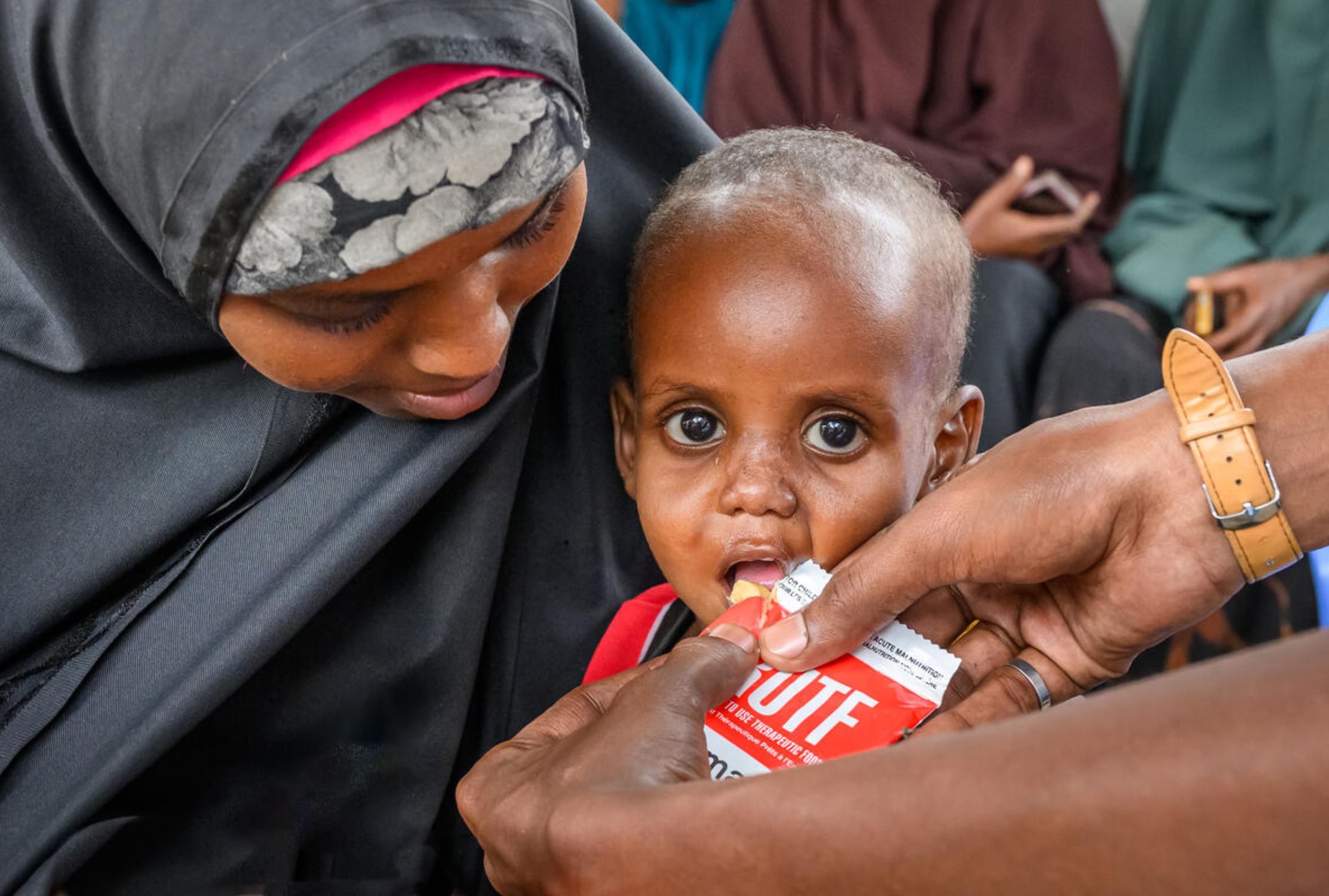 A 18-month-old boy from Somalia sits on his mother's lap and sucks from a packet of nutritional supplements